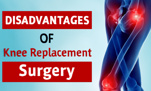 A digital graphic depicting the disadvantages of knee replacement surgery. The image features a semi-transparent X-ray of a knee joint with glowing red highlights. Bold red text on the left reads "DISADVANTAGES OF Knee Replacement Surgery," contrasting against a cool blue background.