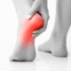 A black-and-white close-up photograph of a person's left foot showing heel pain. The heel area is highlighted in red to indicate inflammation or discomfort. The person's hand gently holds the heel, with the right foot blurred in the background. The scene is set on a reflective white surface.