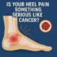 An infographic showing a foot with heel pain and a cancer mass, with the text Is Heel Pain a Sign of Cancer? COULD IT BE CANCER?