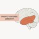A side view of the brain highlighting the frontal and temporal lobes, labeled for Frontotemporal Dementia.