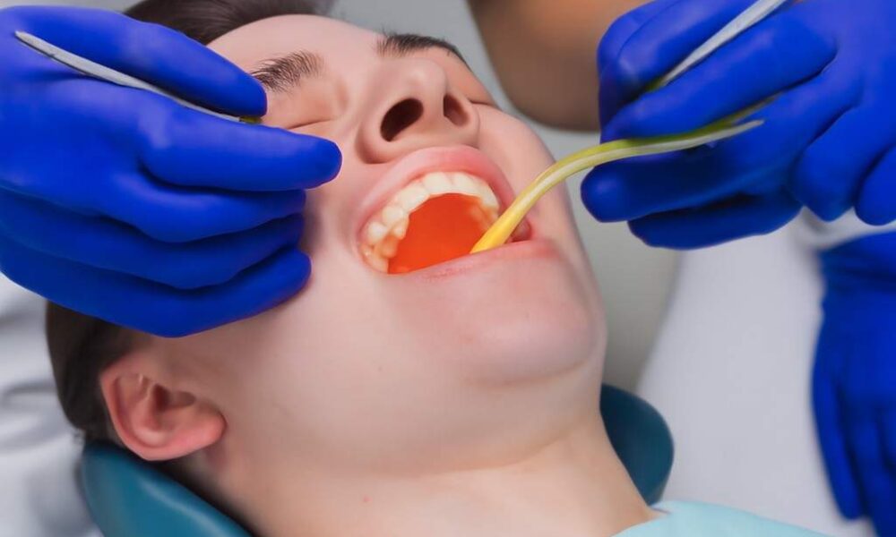 Dentist filling a cavity in a patient's tooth. How Long Does It Take to Fill a Cavity?